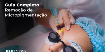 Guia-completo-remoção-de-micropigmentação