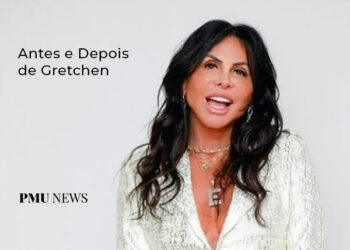 antes-e-depois-de-gretchen-no-tratamento-de-micropigmentação