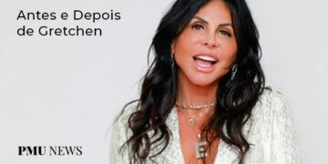 antes-e-depois-de-gretchen-no-tratamento-de-micropigmentação