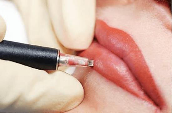 Agulha para Dermógrafo