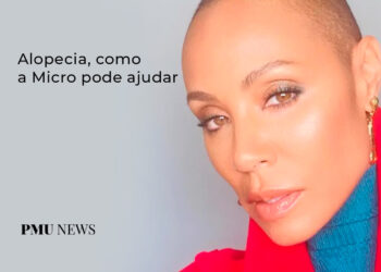 alopecia-na-micropigmentação