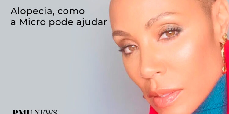 alopecia-na-micropigmentação