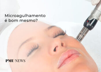 microagulhamento-vale-a-pena