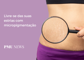 Estrias: Como se livrar delas com micropigmentação