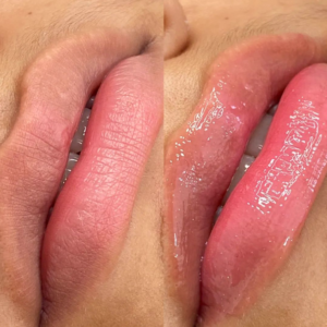 tratamento hydra gloss lips