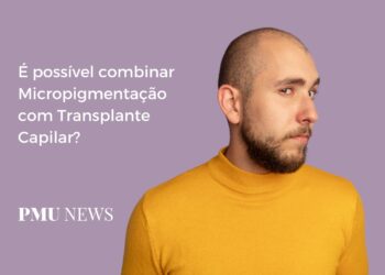 Posso fazer Transplante Capilar após uma Micropigmentação Capilar