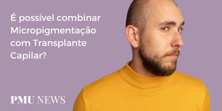 Posso fazer Transplante Capilar após uma Micropigmentação Capilar