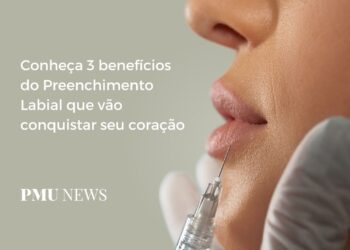 3 razões para apostar no Preenchimento Labial