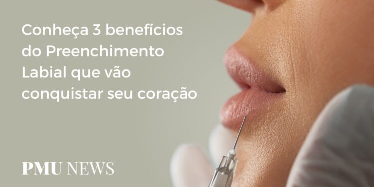 3 razões para apostar no Preenchimento Labial