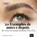 20 Exemplos de Micropigmentação Fio a Fio no Tebori e Dermógrafo – Antes e Depois
