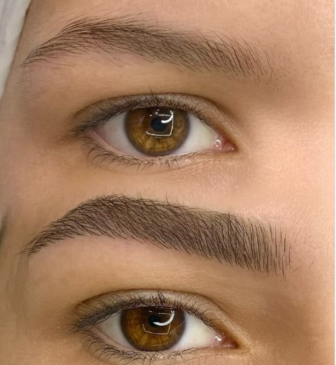 fio a fio no dermografo antes e depois exemplo - 6